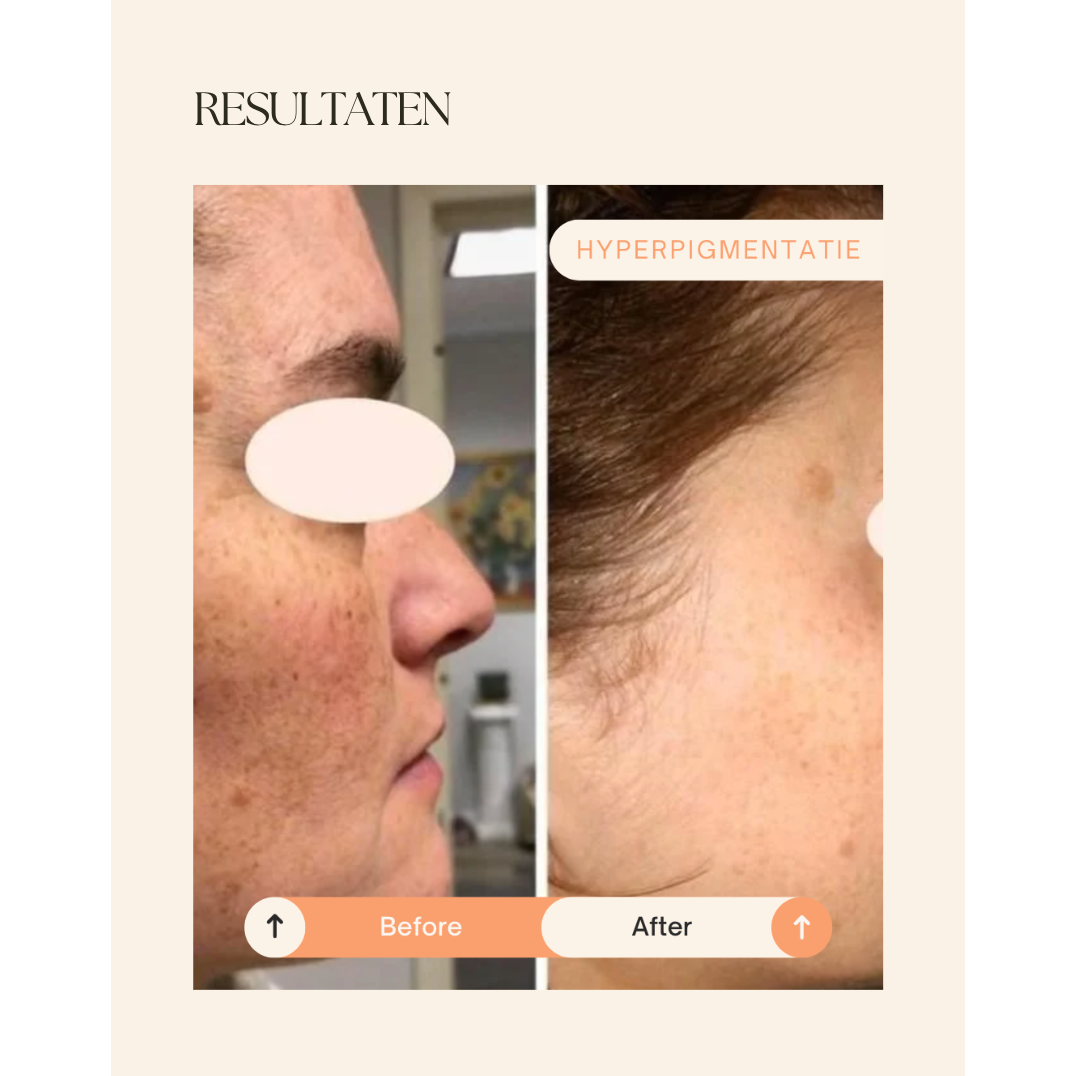 NIEUW! Dermalab Cell Core Pro Led Masker - met gratis ontsmettingsdoekjes en zenzaboek