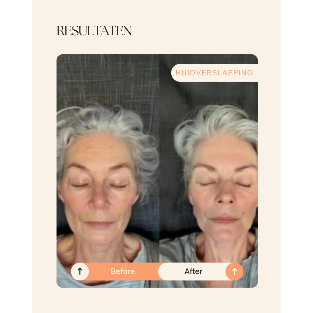NIEUW! Dermalab Cell Core Pro Led Masker - met gratis ontsmettingsdoekjes en zenzaboek