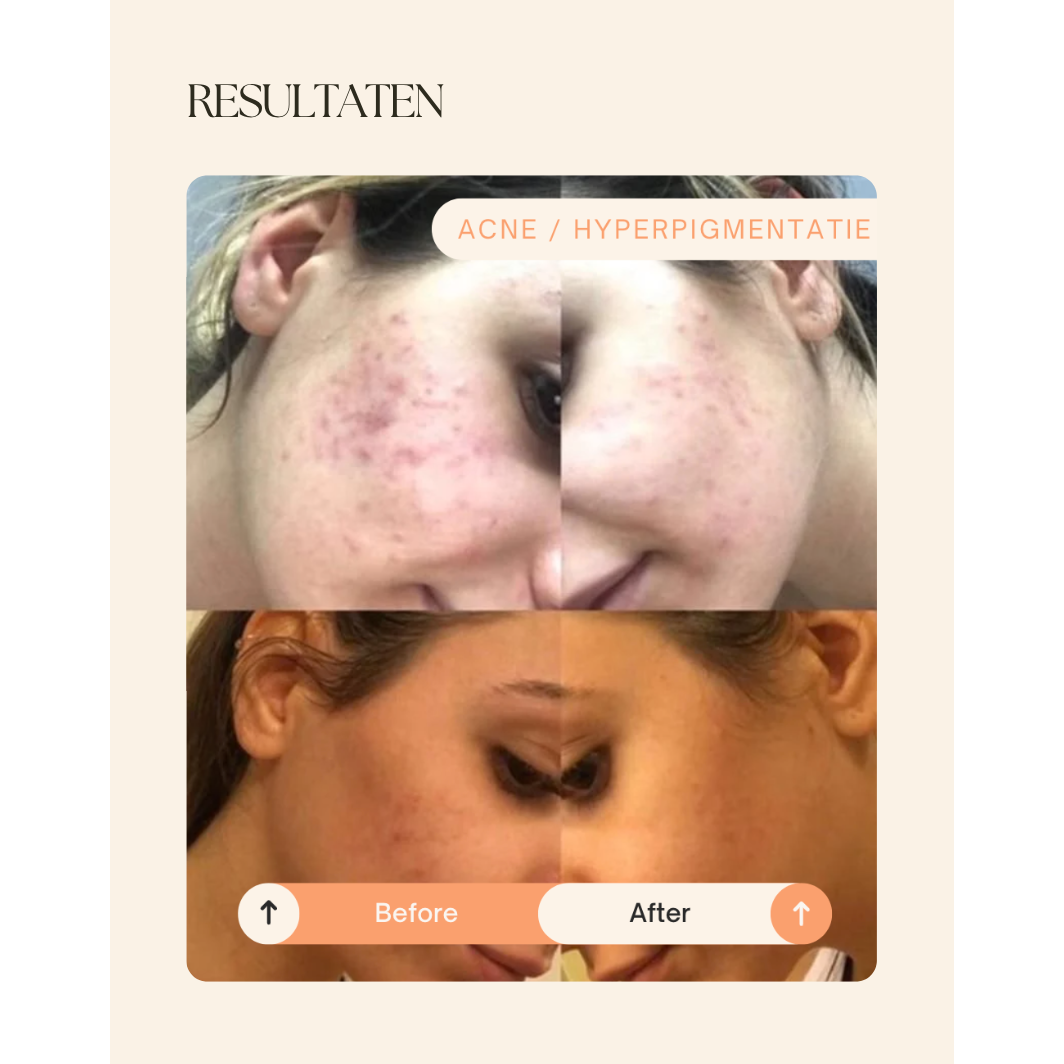 NIEUW! Dermalab Cell Core Pro Led Masker - met gratis ontsmettingsdoekjes en zenzaboek