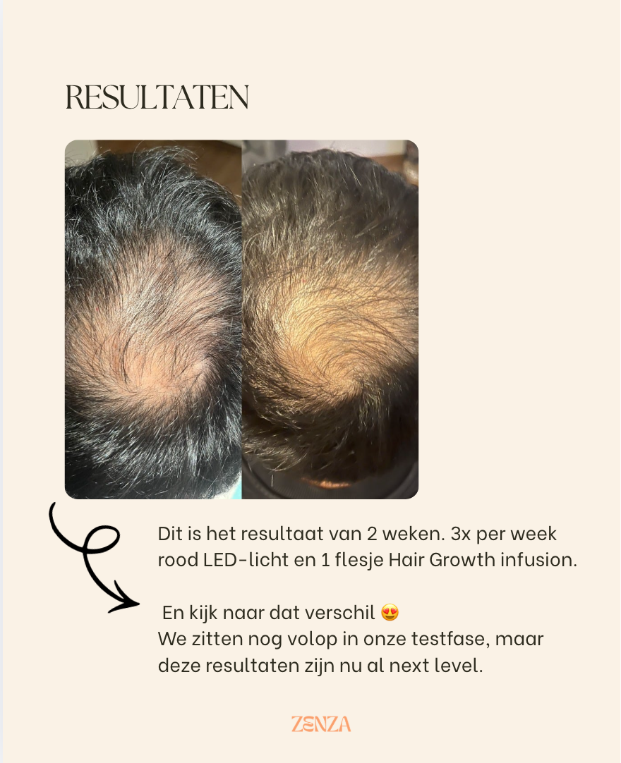 NIEUW! Dermalab - Hair Growth Infusion Box (6stuks) + Gratis Scalp Brush