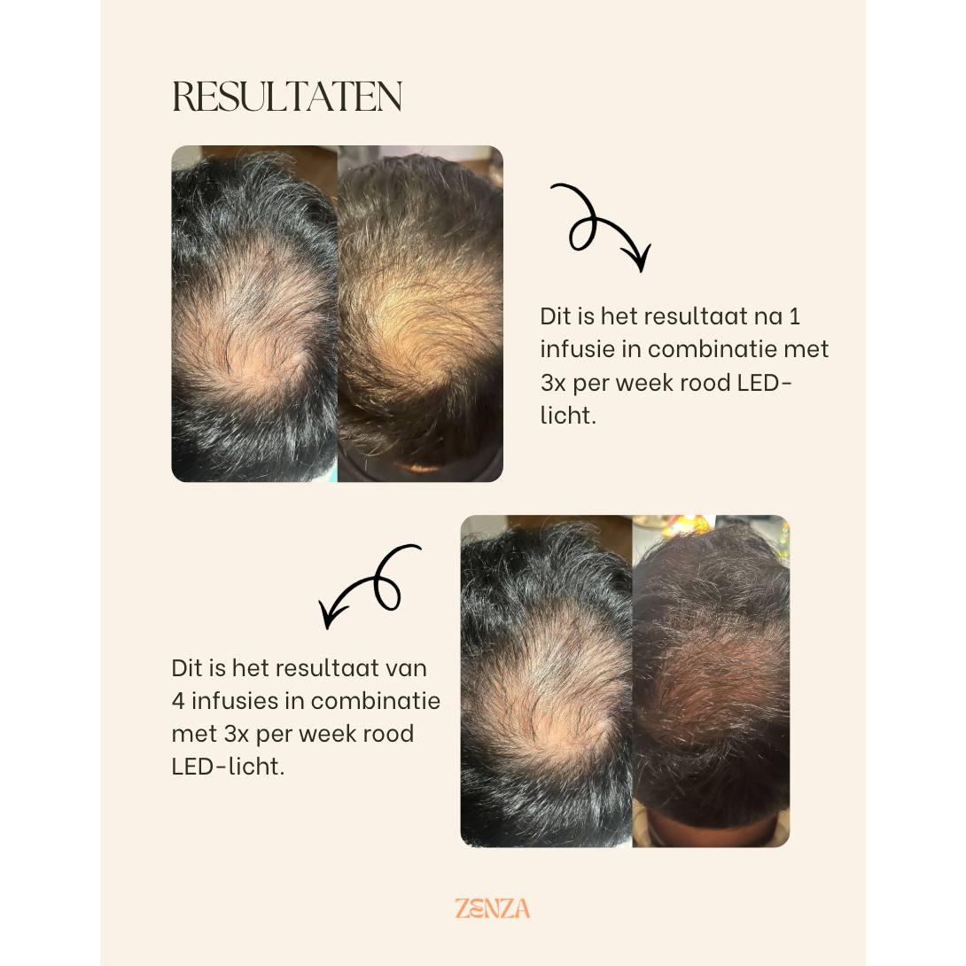 NIEUW! Dermalab - Hair Growth Infusion Box (6stuks)