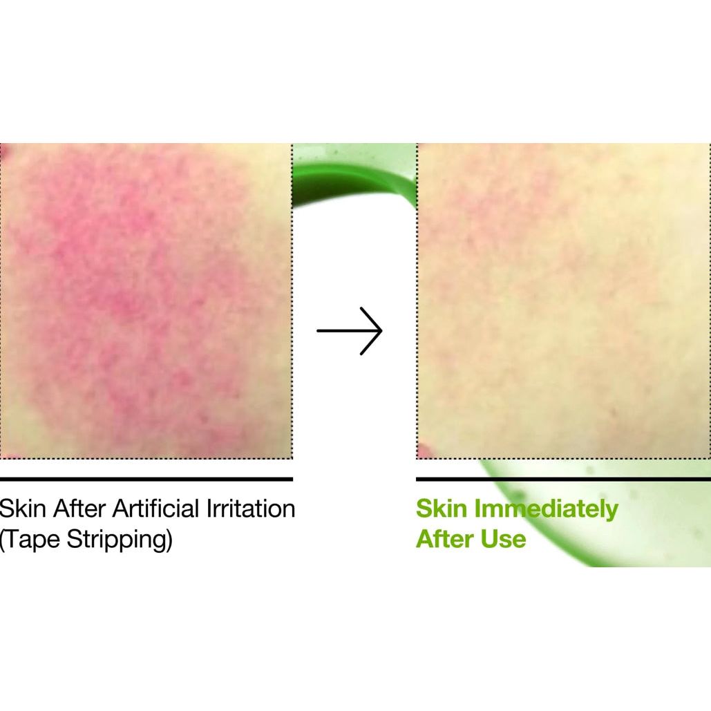 ZenZa Anua azelaic acid