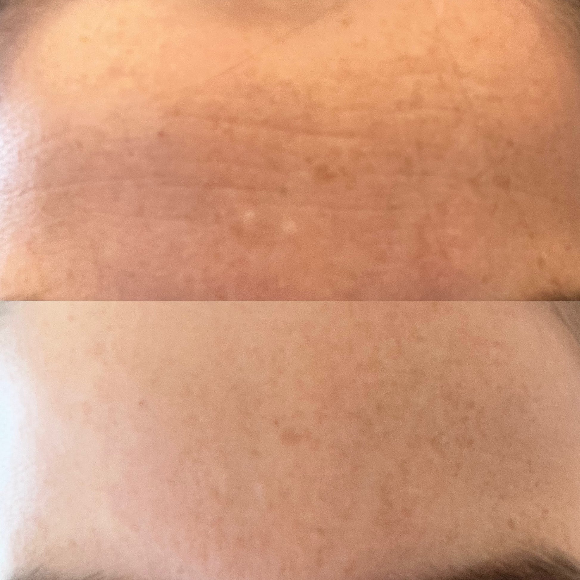 Zenza emmagen age-less facial mask