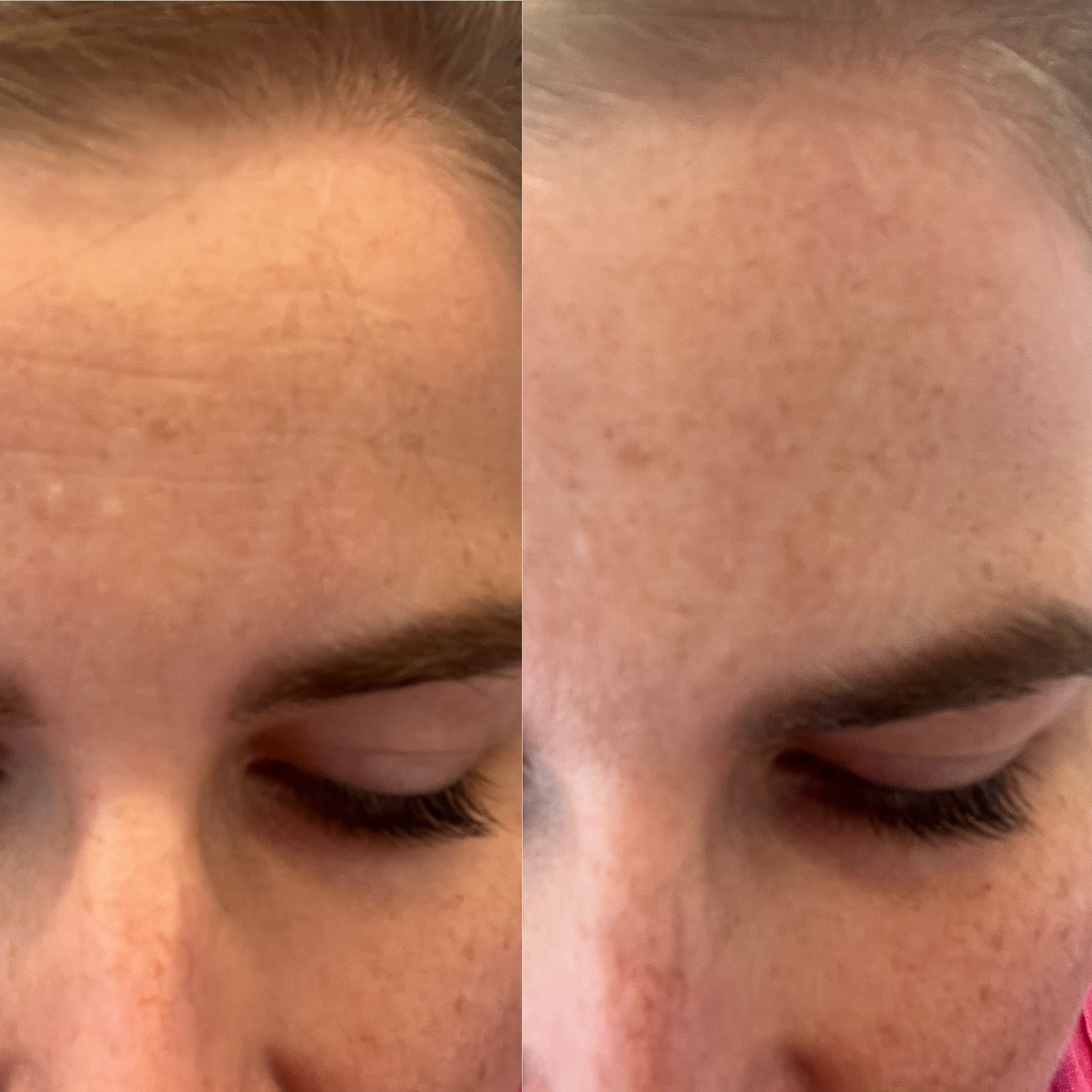 Zenza emmagen age-less facial mask