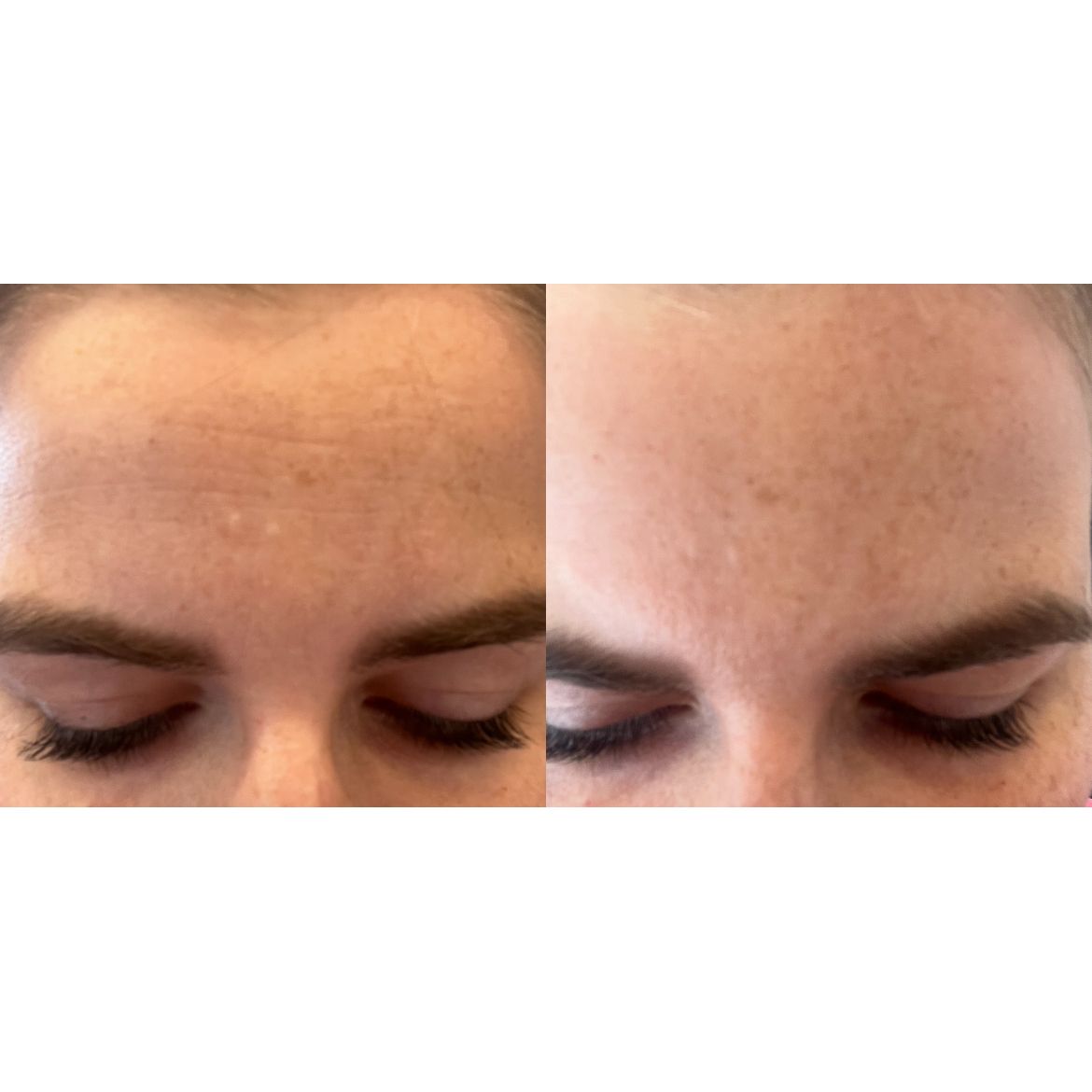 Zenza emmagen age-less facial mask