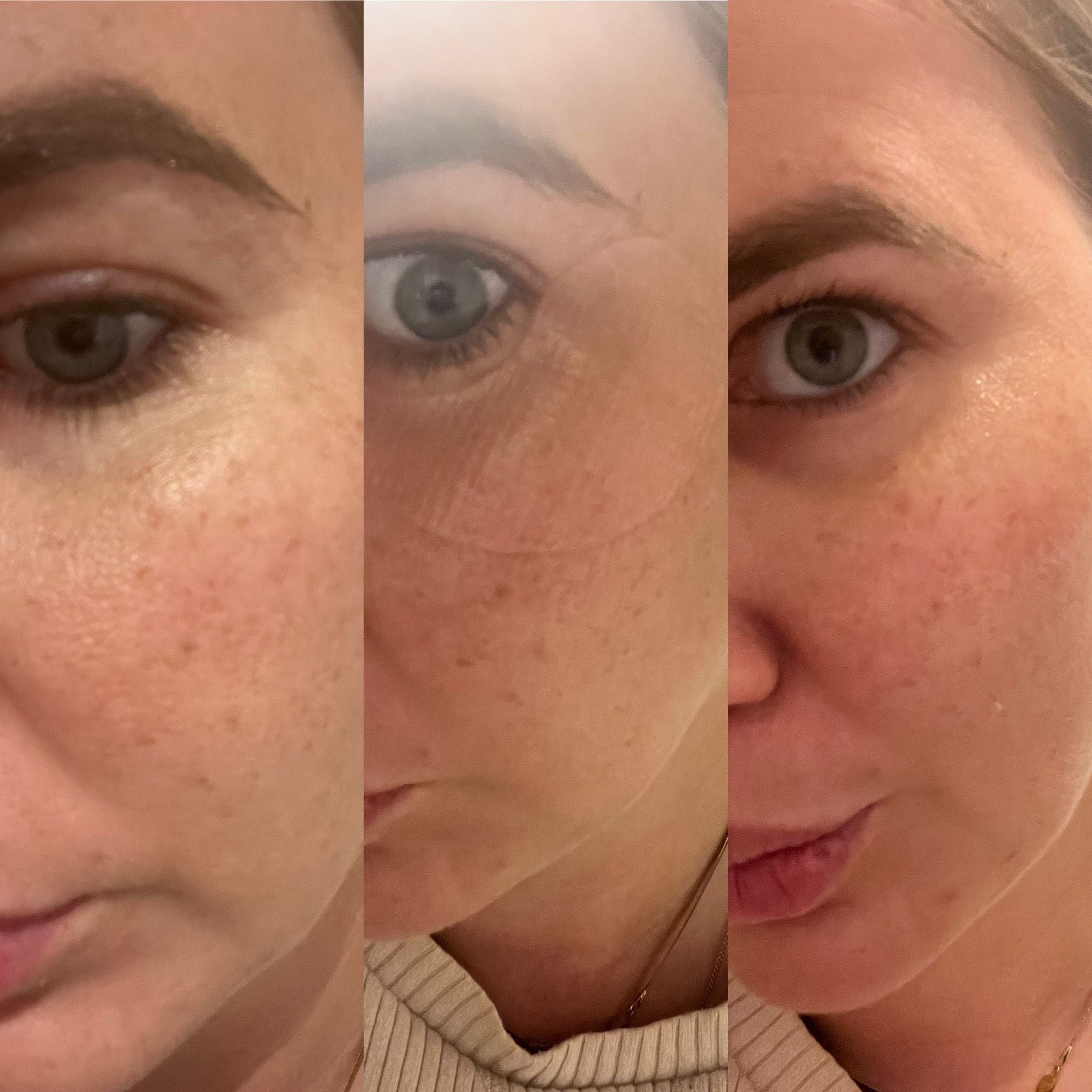 NIEUW! Plump & Lift Eyes Duo: PDRN Eye Patches (60stuks) en Reedle Shot Eye Cream 15ml